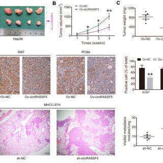 Circrassf Inhibits The Growth And Metastasis Of Hcc In Vivo A We