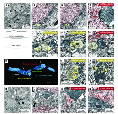 Immuno Electron Microscopy Characterization Of Pcdh11x KO KA GC