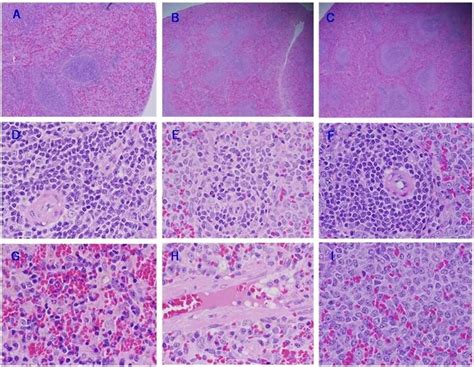 Representative Spleen Histological Sections Stained With H E Of Control