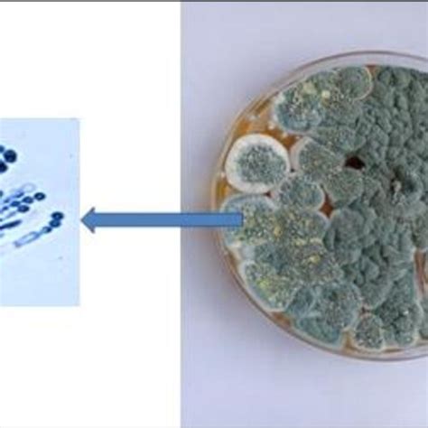 Penicillim Growing On Pda Plate Right Microscopic Preparation