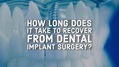 How Long Does It Take To Recover From Dental Implant Surgery Youtube