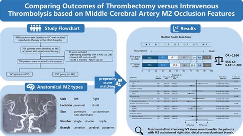 Comparing Outcomes Of Thrombectomy Versus Intravenous Thrombolysis Based On Middle Cerebral