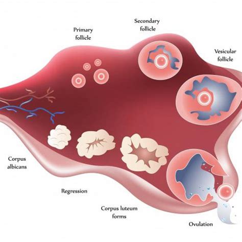 Female right groin pain. Ovarian cyst pain. - All information about cysts