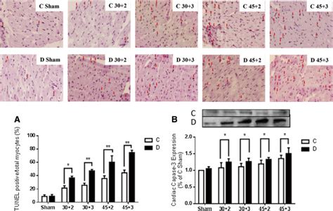 Myocardial Cell Apoptosis Assessed By Tunel Staining And Cardiac