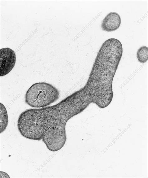 TEM of Bifidobacterium bifidum - Stock Image - B220/0267 - Science ...