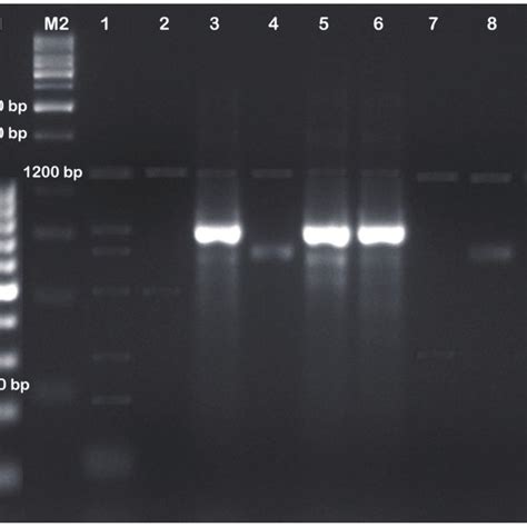 Figure Pcr Results Of Candida Serotypes M And M Bp Dna