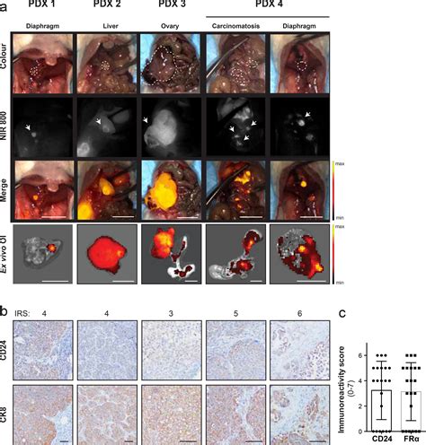 CD24 Targeted Intraoperative Fluorescence Image Guided Surgery Leads To