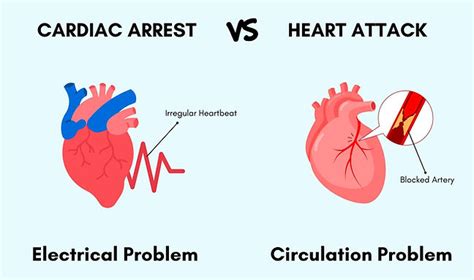 Cardiac Arrest Vs Heart Attack Safe Medical Trainin