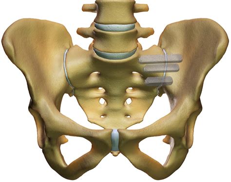 What Are The Treatment Options For Sacroiliitis New Jersey Spine