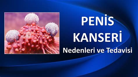 Pen S Kanser Neden Olur Nas L Tedavi Edilir Youtube