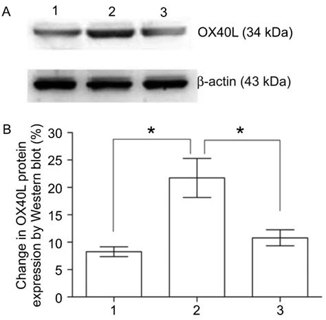 A Ox40l Expression Levels In Huvecs Treated With 1 No Ox Ldl