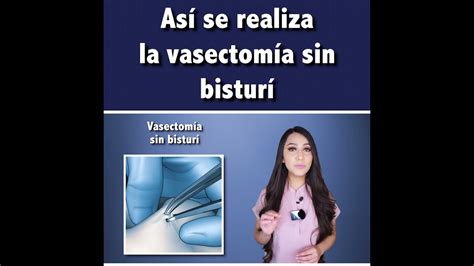 Así Se Realiza La Vasectomía Sin Bisturí👩🏻‍⚕️ Youtube