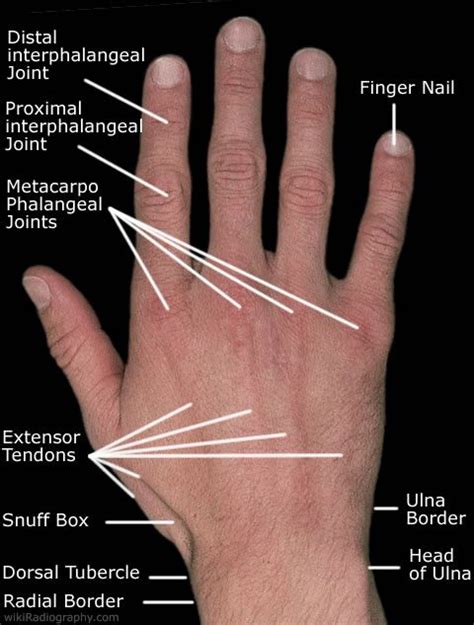 Handwrist Hand Wrist Hand Therapy Anatomy