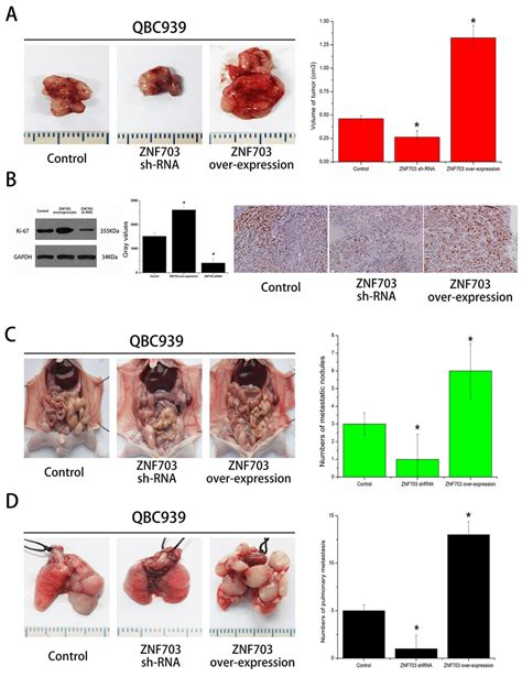 Znf703 Promotes Cca Tumor Growth And Metastasis In Vivo A Download Scientific Diagram