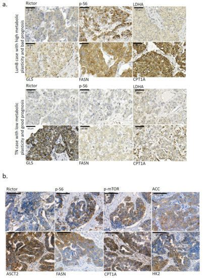 Ijms Free Full Text Characterisation Of 3d Bioprinted Human Breast