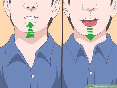 5 Ways to Cure Hiccups - wikiHow