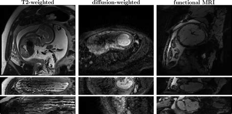 Figure 1 From Fetal BET Brain Extraction Tool For Fetal MRI Semantic