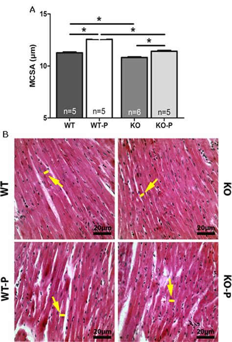 Deletion Of The Mas Receptor Attenuates The Hypertrophy Induced By