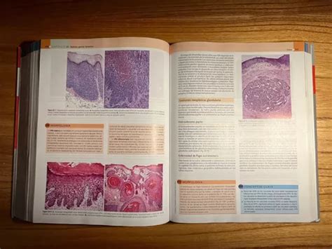 Patologia Estructural Y Funcional Robbins Y Cotran 9º Ed en venta