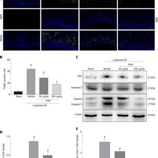 Irisin Reduces Intestinal Oxidative Stress In Experimental Acute