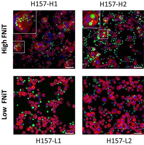 Frontiers Role Of Heterotypic Neutrophil In Tumor Structure In The