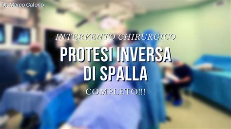 PROTESI INVERSA DI SPALLA INTERVENTO COMPLETO YouTube