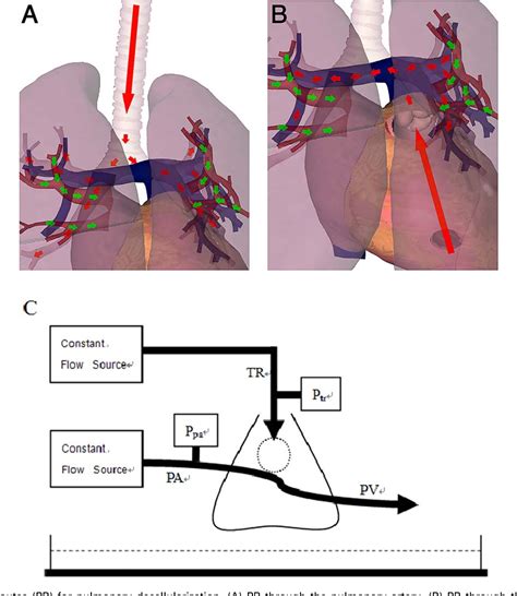 Figure 1 From Comparative Study Of Two Perfusion Routes With Different