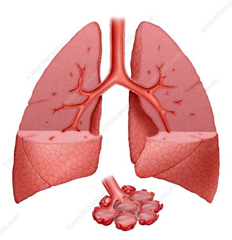 Cancer Symptoms: Fluid On Lungs Symptoms Cancer