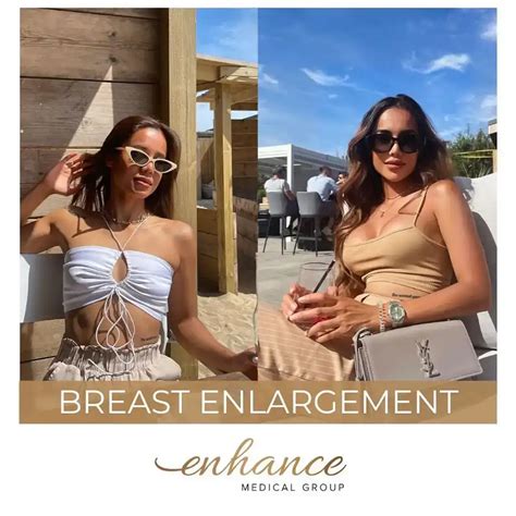 Breast Enlargement London From 4 600 Enhance Medical