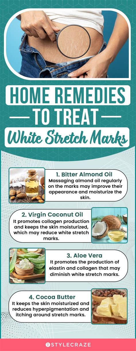 How To Get Rid Of Stretch Marks Home Remedies