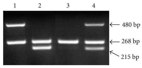 Genotyping Of Gstm And Gstt By Multiplex Pcr Lane Null Gstm