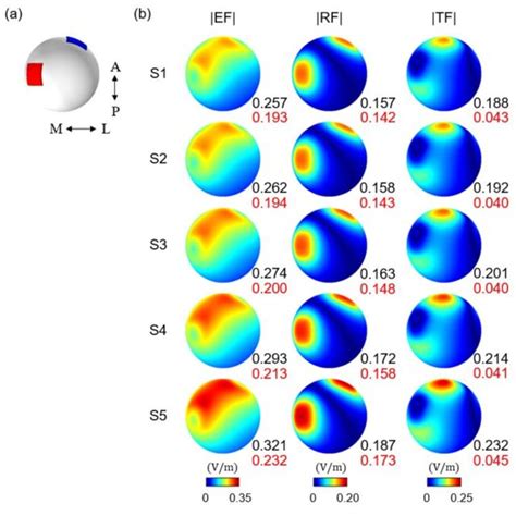 Spatial Distributions Of The Conventional TDCS Used To Stimulate The