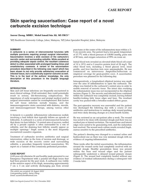 Carbuncle Excision Technique | PDF | Wound | Surgery