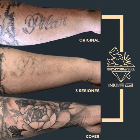 TATUAJES ANTES Y DESPUÉS SOMETER AL LÁSER QUITATTOOAVERIA