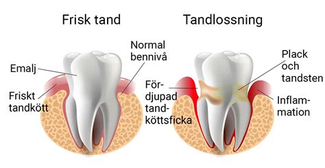 Allmän information om tandvård Tandläkare Unnegård Västerås