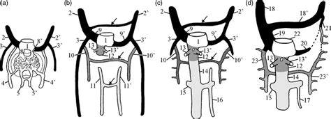 A D Embryonic Development Of The Main Veins 1 Sinus Venosus 2 And 2 Download Scientific