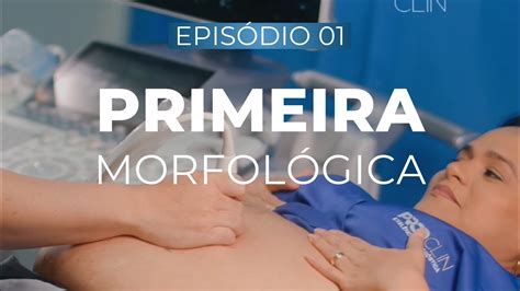 Quando Fazer A Primeira Morfológica - PRIMEIRA MORFOLÓGICA (ultrassom morfológica de primeiro trimestre ...
