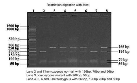 Part 2 Analysing And Interpreting Agarose Gel Electrophoresis Results