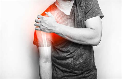 Shoulder Arthritis Types Causes Symptoms Diagnosis And Treatment Of