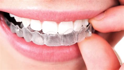 Teeth-straightening startup gets $3 billion valuation