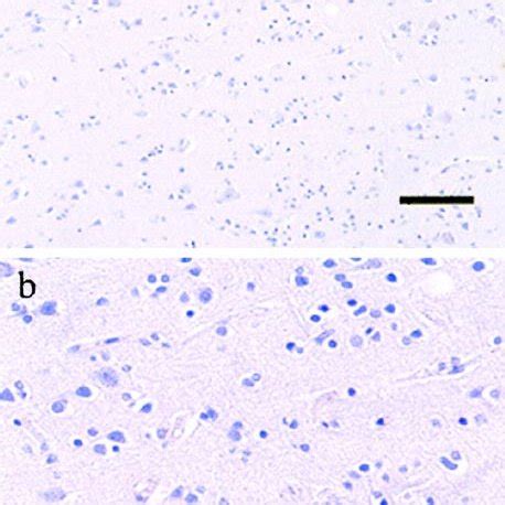 Nestin Immunostaining Of Control Human Brain Tissues A Human Cortex