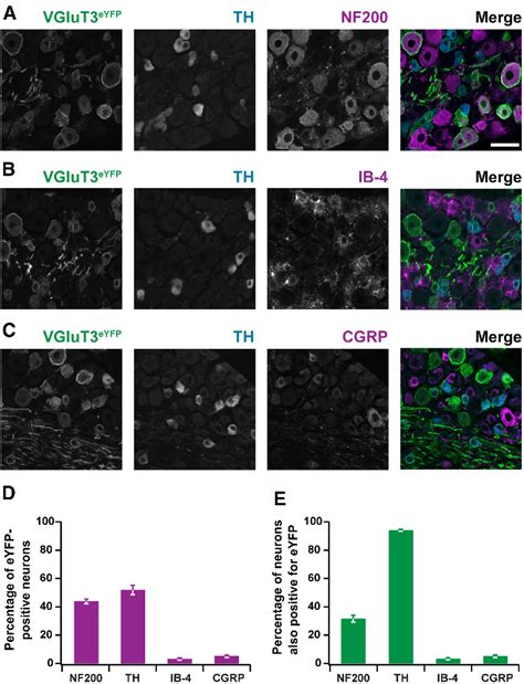 Figure 1 From VGluT3 Primary Afferents Play Distinct Roles In