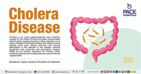 Cholera Disease Symptoms Causes Types And Treatment