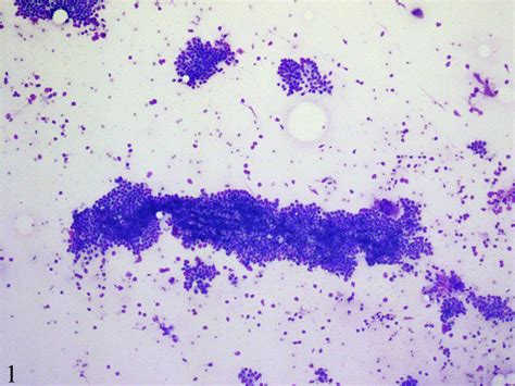 Fine Needle Aspiration Cytology Smears Are Moderately Cellular And