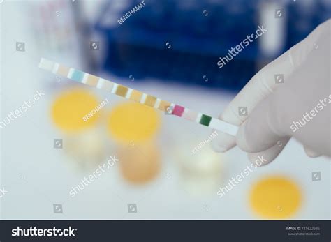 Reagent Strip Urinalysis Routine Urinalysis Checkup Stock Photo