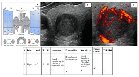 Jcm Free Full Text The European Institute Of Oncology Thyroid