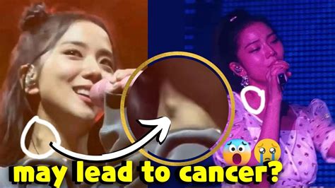 Blackpink Jisoo Suffers From A Critical Medical Condition😨 Youtube