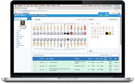 Best Dental charting software | Graphical tooth chart(2022)