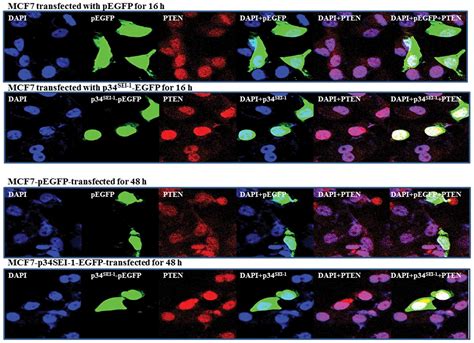 Oncogenic Function Of P34sei 1 Via Nedd4‑1‑mediated Pten Ubiquitination