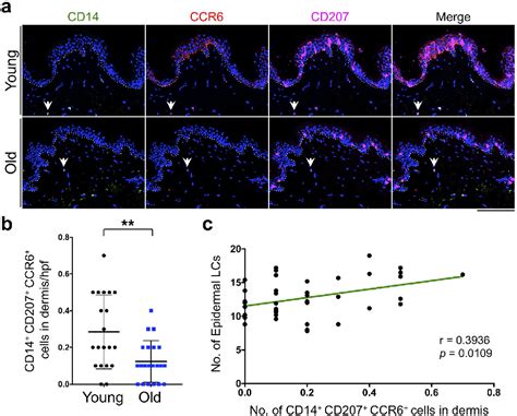 Table 1 From Reduction In Human Epidermal Langerhans Cells With Age Is